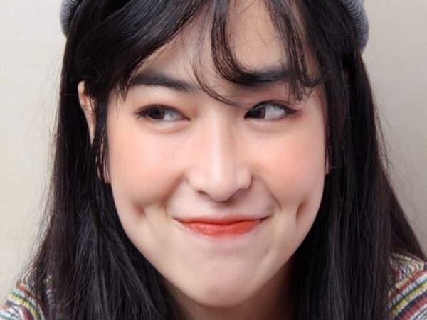 Có mấy kiểu má lúm đồng tiền