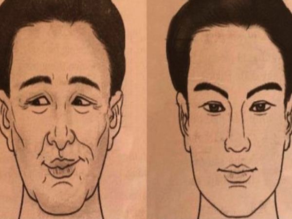 Tướng người đàn ông nghèo khổ