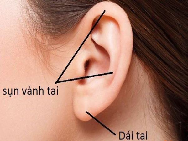 vận số tướng người tai nhỏ