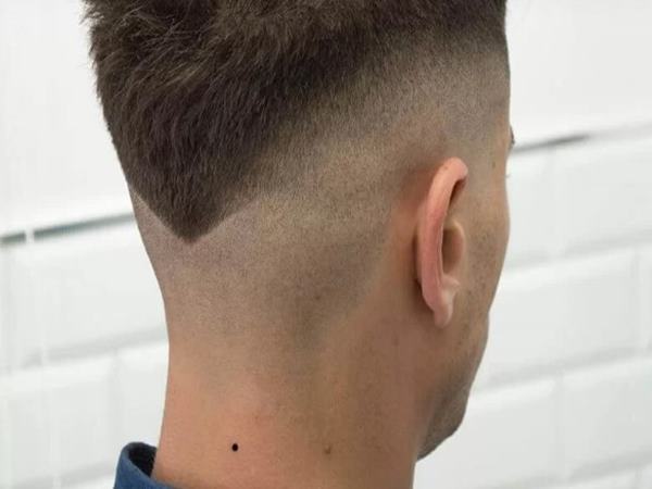 nốt ruồi sau gáy ở đàn ông