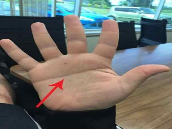 Xem chỉ tay chữ Y đoán vận mênh, tình duyên của con người