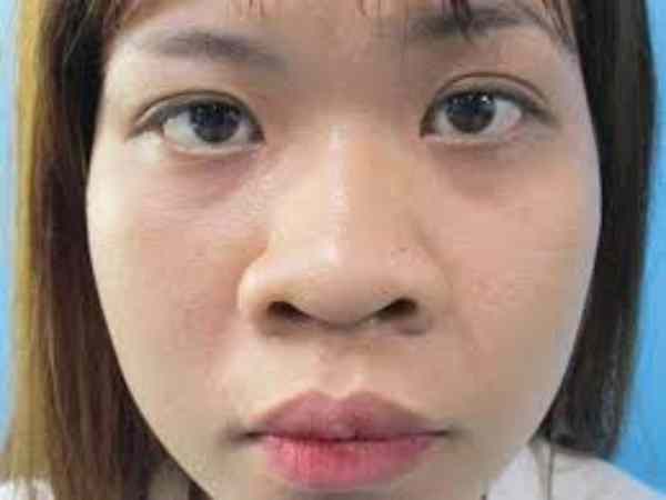 Như thế nào là phụ nữ mũi to?