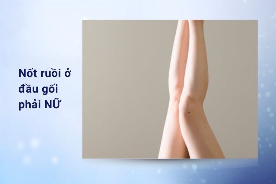 Nốt ruồi ở đầu gối phải Nữ