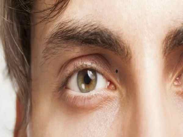 Nốt ruồi ở mi mắt nam và nữ có vận mệnh như thế nào?
