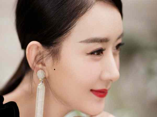 Nốt ruồi ở tóc mai nói lên vận mệnh và tình duyên như nào?